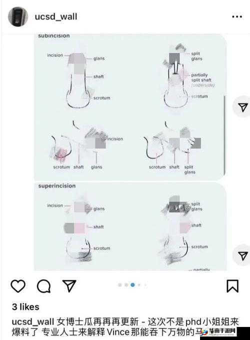 人怎么进入羊水门：探究其方法