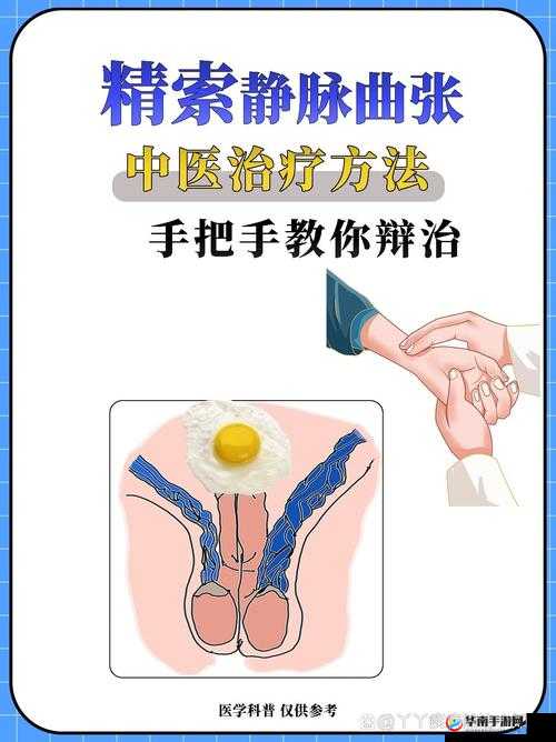 胡桃夹精索静脉曲张能治好吗：专家解读治疗方法与效果