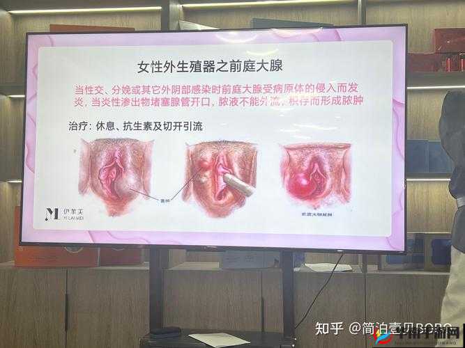 女子：私密处又痒又疼，到底是为什么？