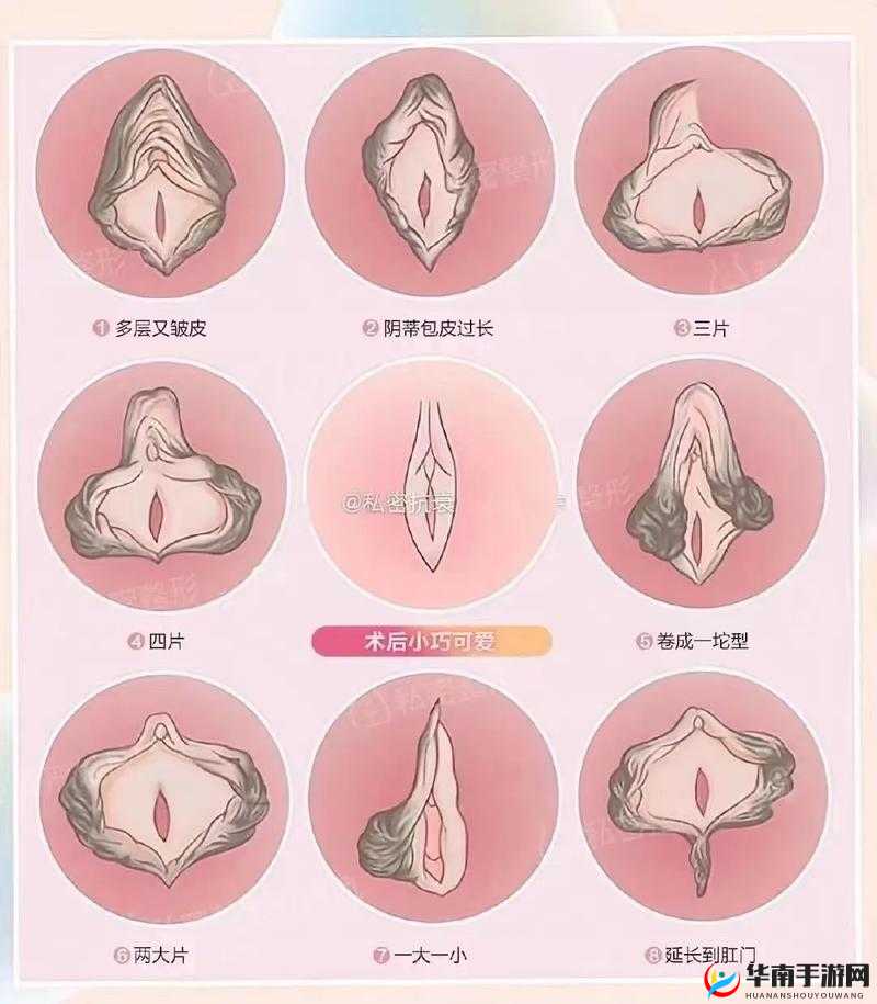 生完孩子后，私密部位的变化：为什么那两瓣越来越小了呢？