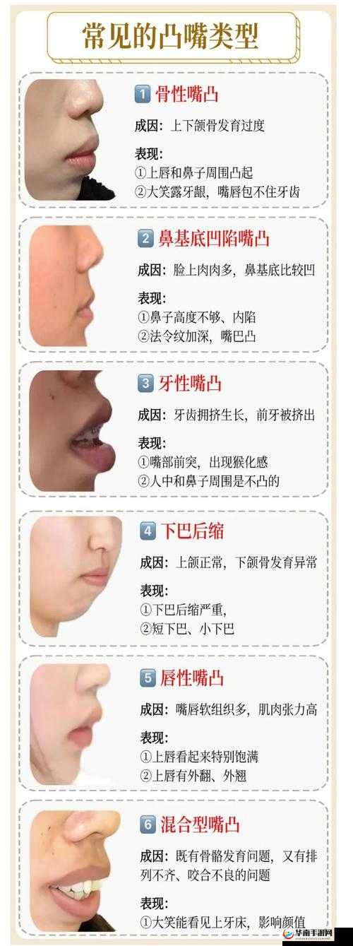 欧美人嘴巴更大还是更小？揭秘不同人种面部特征的差异与科学解释