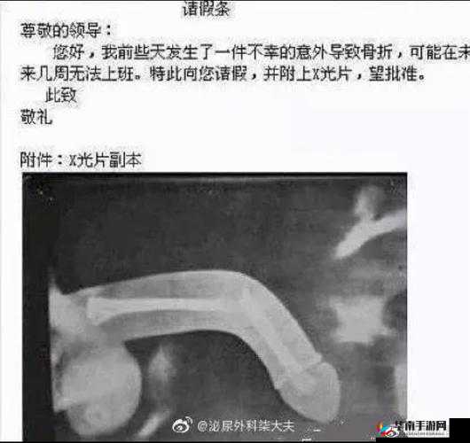 男生第一次进去为何感觉被夹断了？深度剖析其中缘由引关注